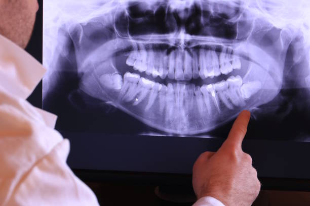 Best Emergency Broken Tooth Repair in Country Clu, FL